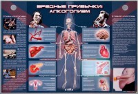 Электрифицированный стенд "Вредные привычки: алкоголизм" - fgospostavki.ru - Ялуторовск