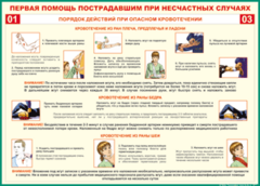Таблица "Порядок действий при опасном кровотечении" (100х140 сантиметров, винил) - fgospostavki.ru - Ялуторовск