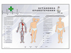Электрифицированный стенд "Остановка кровотечения" - fgospostavki.ru - Ялуторовск